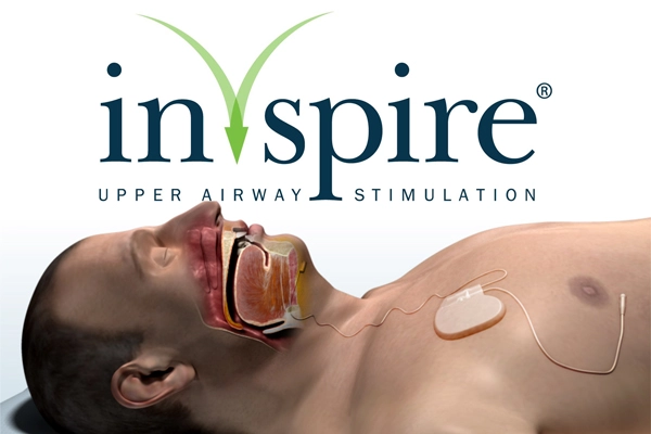 Inspire Sleep Apnea